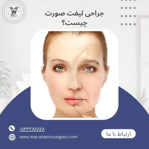 جراحی لیفت صورت