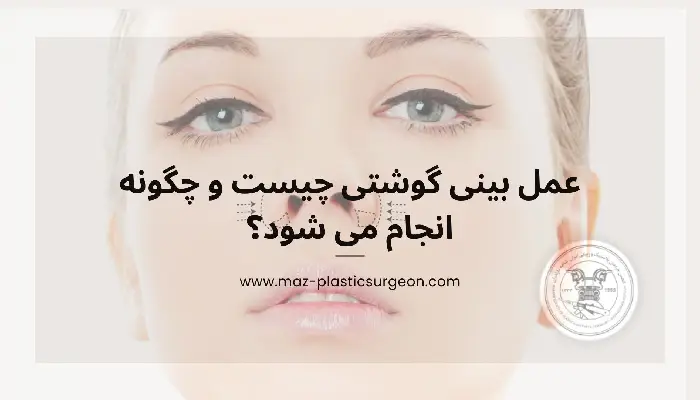 عمل بینی گوشتی