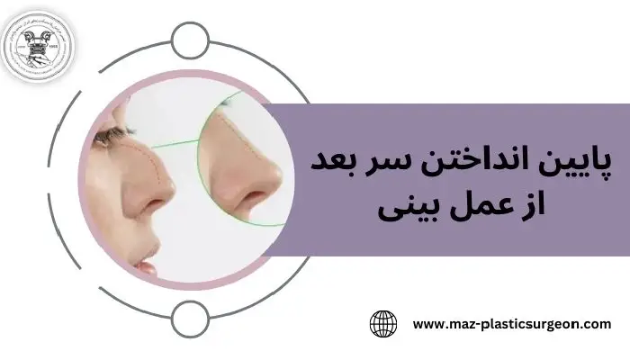 پایین انداختن سر بعد از عمل بینی