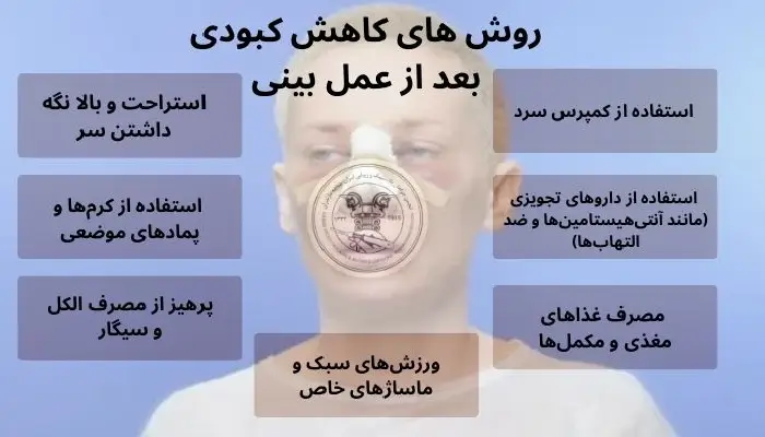 کبودی بعد از عمل بینی