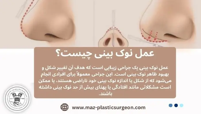 عمل نوک بینی