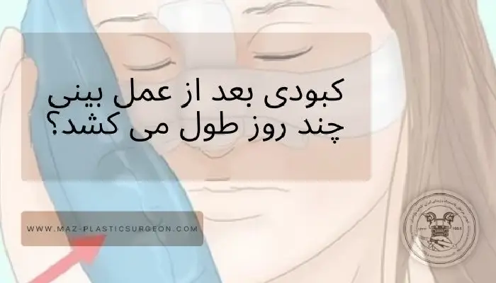 کبودی بعد از عمل بینی