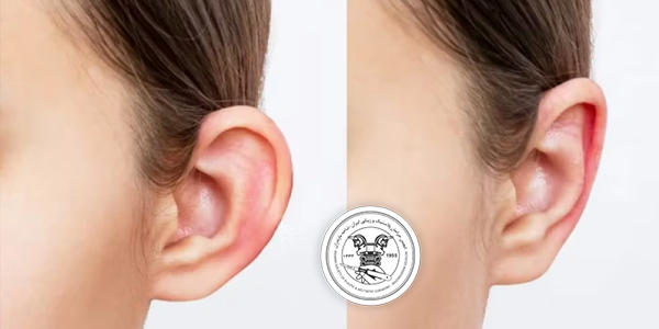 عوارض جراحی زیبایی گوش