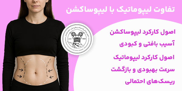 لیپوماتیک یا لیپوساکشن