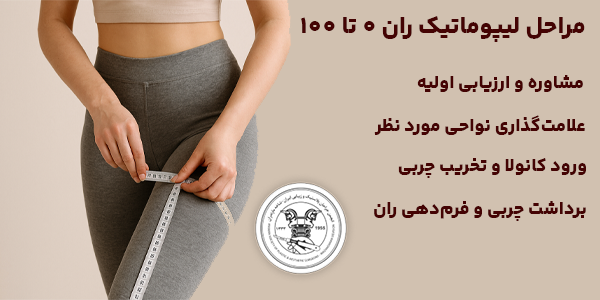 مراحل لیپوماتیک ران