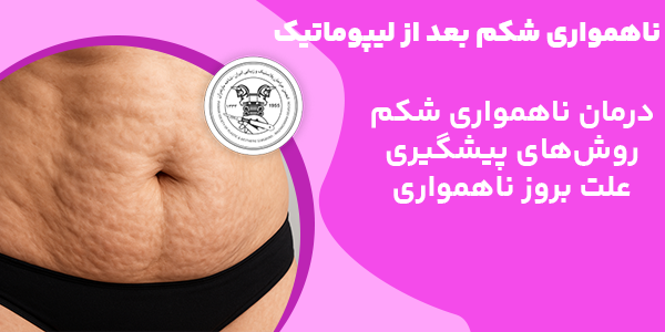 چیست ناهمواری شکم بعد از لیپوماتیک