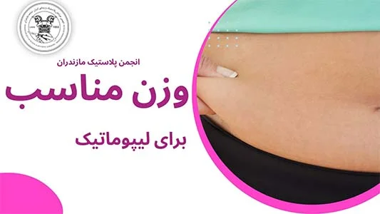 بهترین وزن مناسب برای لیپوماتیک